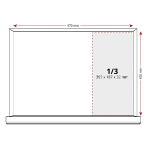 Engine Timing Tool Kit Renault, Opel, Mercedes, Nissan – M9R, M9T, R9M, R9N, OM622, OM626, OM699