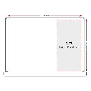 Engine Timing Tool Kit for Audi 4.2L V8 Petrol